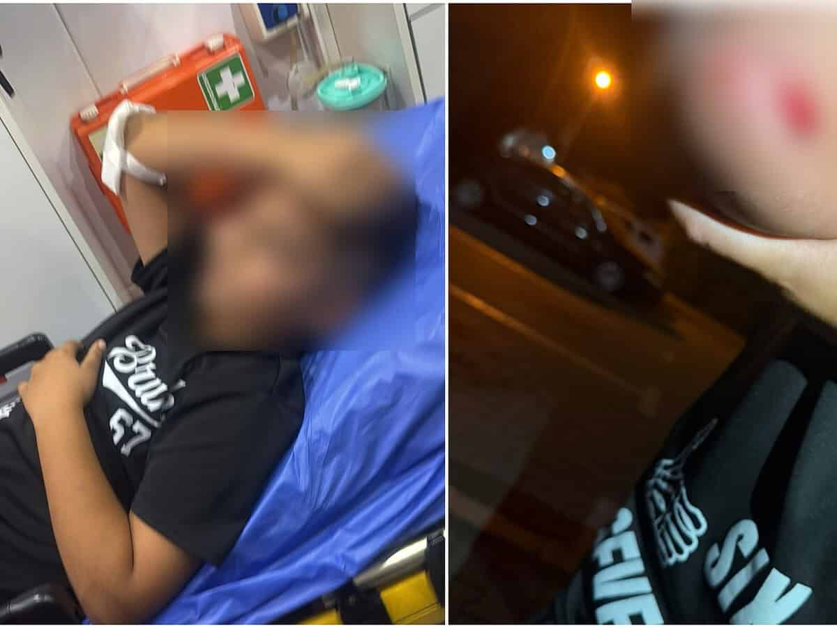 Copil de 12 ani, bătut de administratorul unui bloc din Avrig. Părinții cer să se ia măsuri: „L-a târât pe jos” / foto